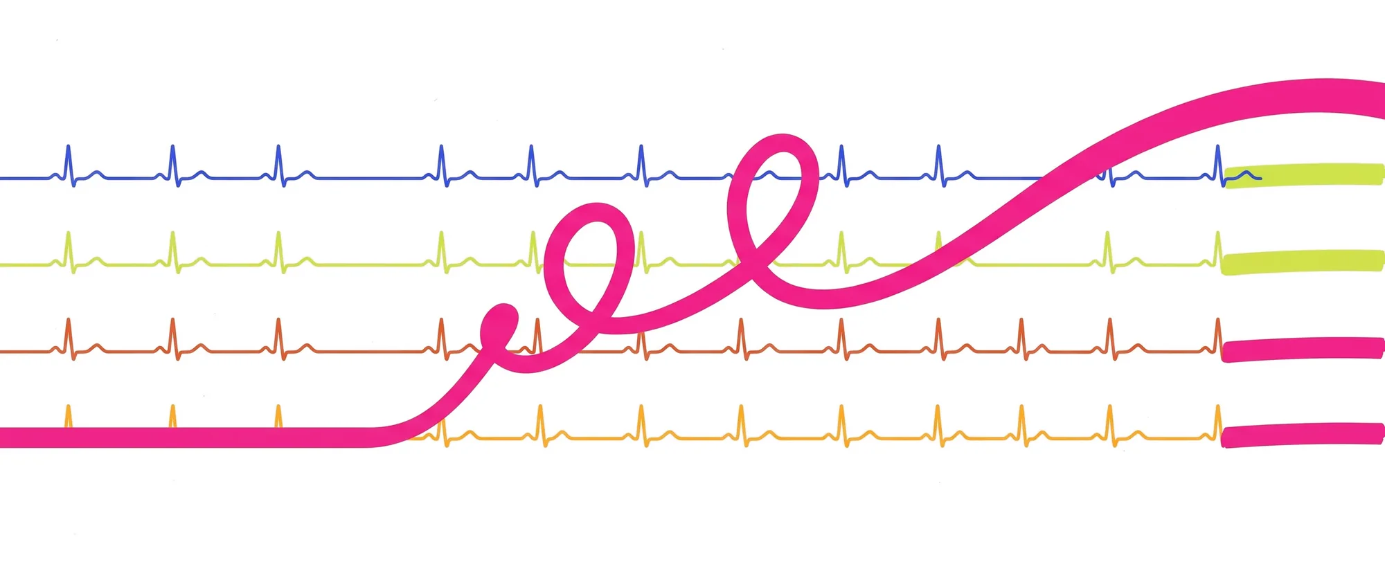 Four steady clinical traces, and a fifth pink line that loops free and rises away above them.